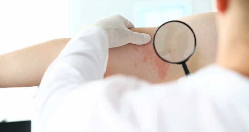 Dermatology Image