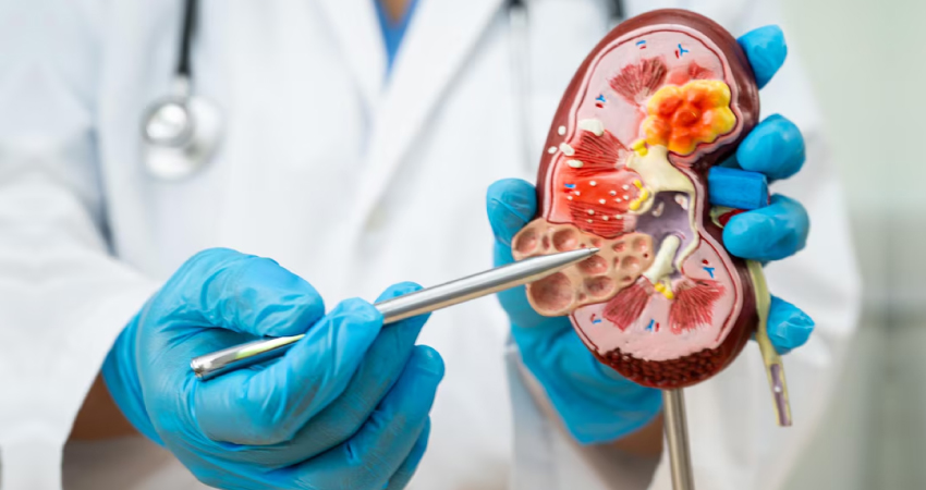 Nephrology Image
